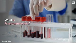 What is Fructosamine test [upl. by Ntsuj]