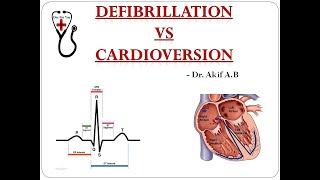 Cardioversion Vs Defibrillation  Dr Akif Baig [upl. by Valenka95]