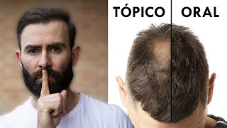 Minoxidil Oral Vs Tópico Para Recuperar El Pelo [upl. by Oremoh]