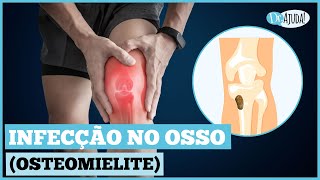 INFECÇÃO NO OSSO OSTEOMIELITE QUAIS OS SINTOMAS O QUE FAZER [upl. by Budde812]