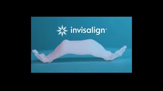 Invisalign Palatal Expander [upl. by Brie89]