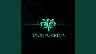 Tachycardia [upl. by Gonta]