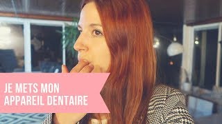 690  JE METS MON APPAREIL DENTAIRE  VLOG FAMILLE [upl. by Auberon473]