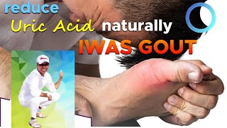 IWAS GOUT  Reduce Uric Acid Naturally [upl. by Ellerihs]