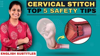 MUST KNOW  Stitched Cervix Dos amp Don’ts I கர்ப்பப்பை தையல் போட்ட பிறகு செய்ய கூடியவை செய்ய கூடாதவை [upl. by Duffie652]