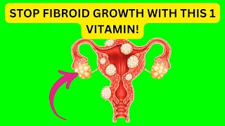 STOP Fibroid Growth with This 1 Vitamin [upl. by Thane]