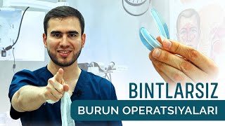 BINTLARSIZ BURUN OPERATSIYALARI LOR qabuli 95 1888688 [upl. by Nalepka349]