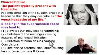 Subarachnoid Hemorrhage [upl. by Eceinahs]