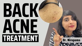 Back Acne Pimples on back Back acne treatment Back acne spots How to get rid of back acne2022 [upl. by Eciralc943]