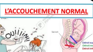 accouchement normal  dernière partie [upl. by Viccora]