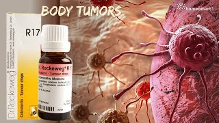 Shrink Tumors Naturally Unveiling Dr Reckewegs R17 Homeopathy Drops [upl. by Nywra]