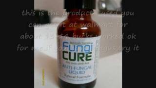 How to Remove Toenail FungusFungi CureToenail Fungus Removal Liquid [upl. by Arait]