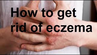 Effective Remedies for Eczema [upl. by Ylsel]