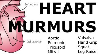 Learn Heart Murmurs In 10 Minutes With Heart Murmur Sounds [upl. by Simara]