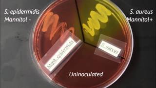 Selective and SelectiveDifferential Media Timelapse [upl. by Ainuj]