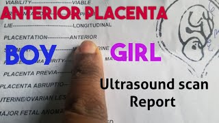 Anterior Placenta Baby GenderUltrasound Scan Report [upl. by Derfniw]