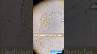 Undigested Food Particles  Stool Microscopy [upl. by Einnahpets700]