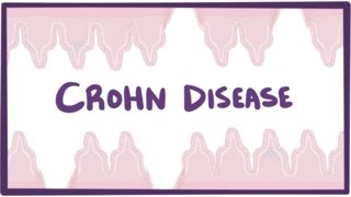 Crohns disease Crohn disease  causes symptoms amp pathology [upl. by Feld778]