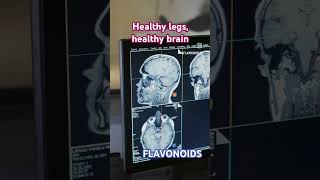 Healthy legs healthy brain blood circulation with Flavonoids legs brain [upl. by Dene]