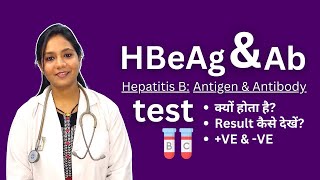 HBeAg and Antibodies Test in Hindi  Positive Negative Result Analysis [upl. by Lahsram305]