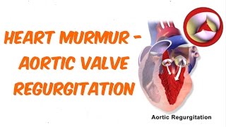 Aortic Regurgitation Auscultation Sound [upl. by Asaret444]