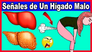 10 Signos de Hígado Enfermo pero lo Peor es que NO Todos lo Saben [upl. by Nap]