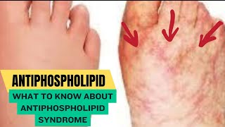 Antiphospholipid Syndrome [upl. by Skilken]