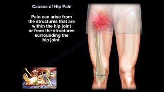 hip pain causes diagnosis and treatment [upl. by Ahsytal]