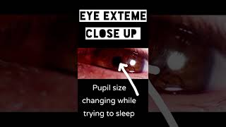 eye anatomy  pupil size changing while trying to sleep  miosis [upl. by Arezzini]