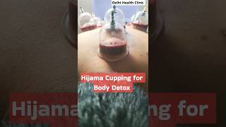 Blood Purification amp Detox Secrets Power of Hijama Cupping hijama cupping detox [upl. by Anelliw]