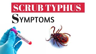 Scrub Typhus  A rare disease  Dr Satpathy [upl. by Hakaber80]