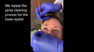 Zest  Demodex Blepharitis Eyelashes Cleaning [upl. by Dumah]