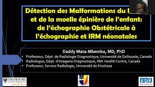 Détection des Malformations du Rachis du Foetus et de lEnfant à l’Echographie et à lIRM [upl. by Dnartreb387]