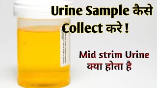 mid stream urine collection procedure II urine specimen collection procedure [upl. by Hoag]