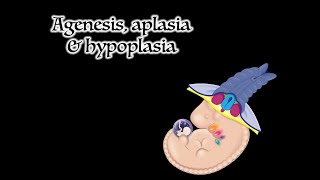 Agenesis Aplasia and Hypoplasia [upl. by Ynohtn856]