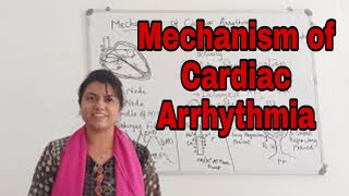 Mechanism of Cardiac arrhythmia [upl. by Lamb]