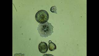 RADIOLARIANS [upl. by Orestes]