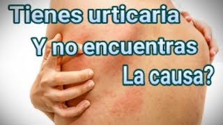 Mi experiencia con urticaria y sarpullido por fin encontré la causa [upl. by Laeno]