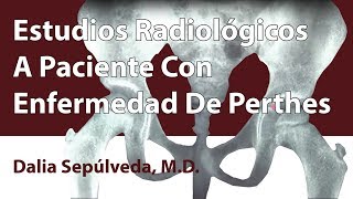 Estudios Radiológicos A Paciente Con Enfermedad De Perthes [upl. by Malanie]