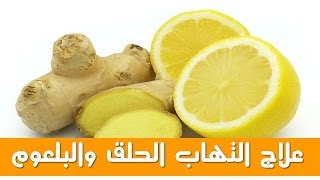 وصفة الدكتور جمال الصقلي لعلاج التهاب الحلق والبلعوم مجربة [upl. by Fiann882]