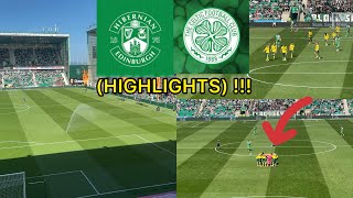 HIBS V CELTIC 02 HIGHLIGHTS [upl. by Herc462]