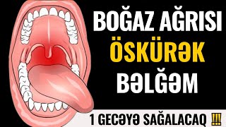 BOĞAZINIZ AĞRIMAYACAQ Öskürəyi 1 Günə TAM KƏSİR [upl. by Leemaj117]