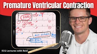 Premature Ventricular Contractions PVC EKG  ECG Lecture [upl. by Nnuahs]