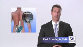 Lumbar Microdiscectomy  Paul R Jeffords MD [upl. by Jody]