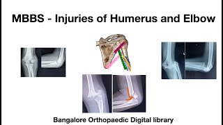 MBBS  Humerus and Elbow injuries [upl. by Miarfe788]