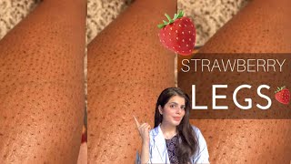 How to Get Rid of Strawberry Legs  Strawberry skin  Strawberry legs Treatment [upl. by Aicsile875]