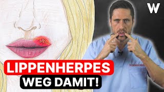 Lippenherpes Wieso kommt Herpes immer wieder Behandlung amp Vorbeugung von Herpesbläschen  Ursachen [upl. by Lavinia]