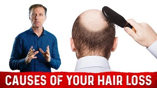 Top 5 Tips for Hair Loss Prevention from an expert trichologist  Hair Transplant Clinic [upl. by Braca]