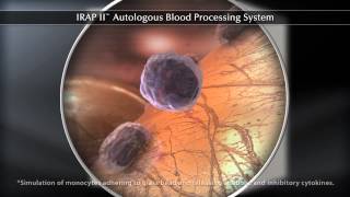 IRAP II™ Autologous Blood Processing System [upl. by Abehs]