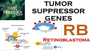 NEOPLASIA 3 TUMOR SUPPRESSOR GENES Retinoblastoma Gene Knudsons Two Hit Hypothesis [upl. by Adeline]